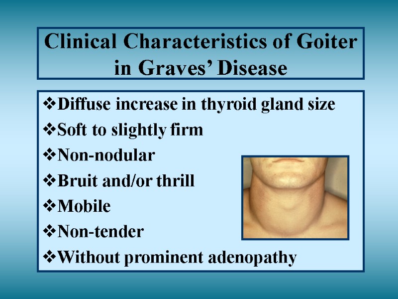 Clinical Characteristics of Goiter in Graves’ Disease Diffuse increase in thyroid gland size Soft